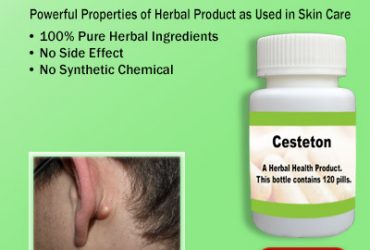 Sebaceous Cyst Natural Treatment