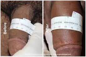 5 in 1 entengo herbal penis growth pdts